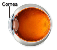 cornea lentes de contacto